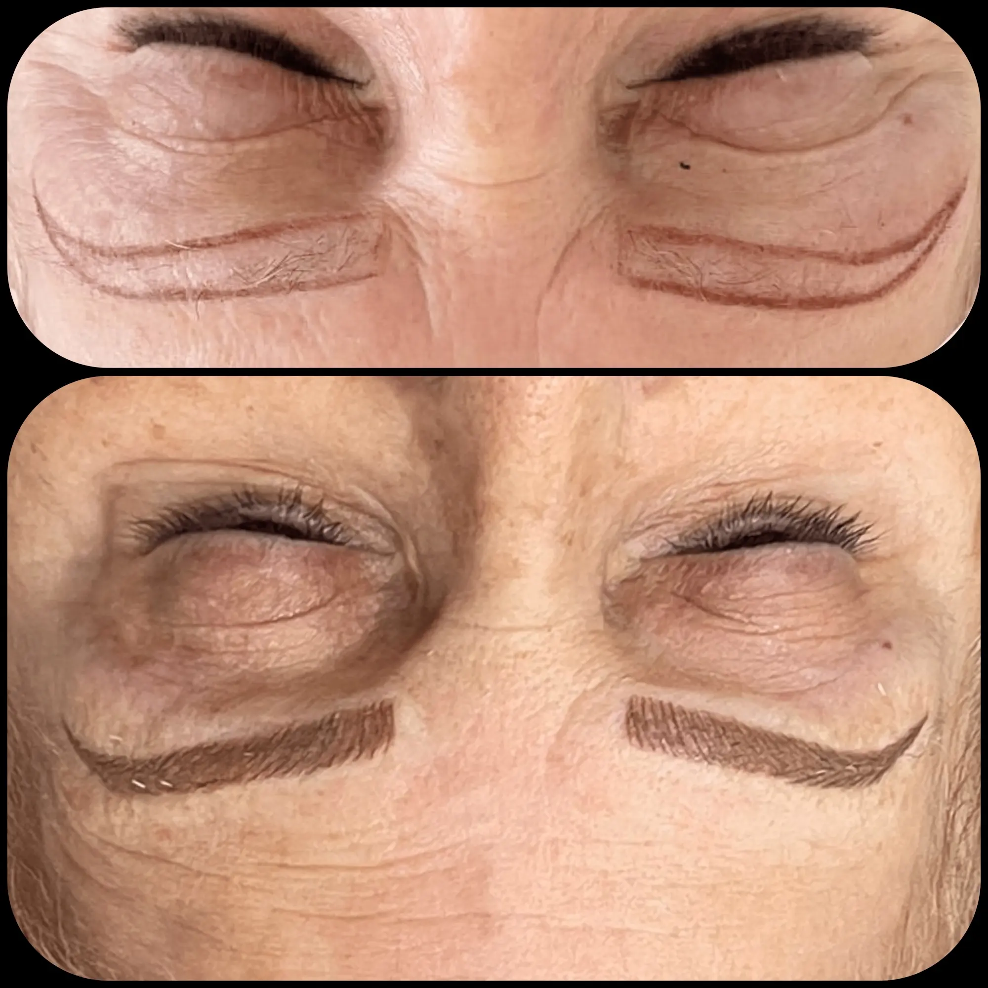 Before and after brow result grid