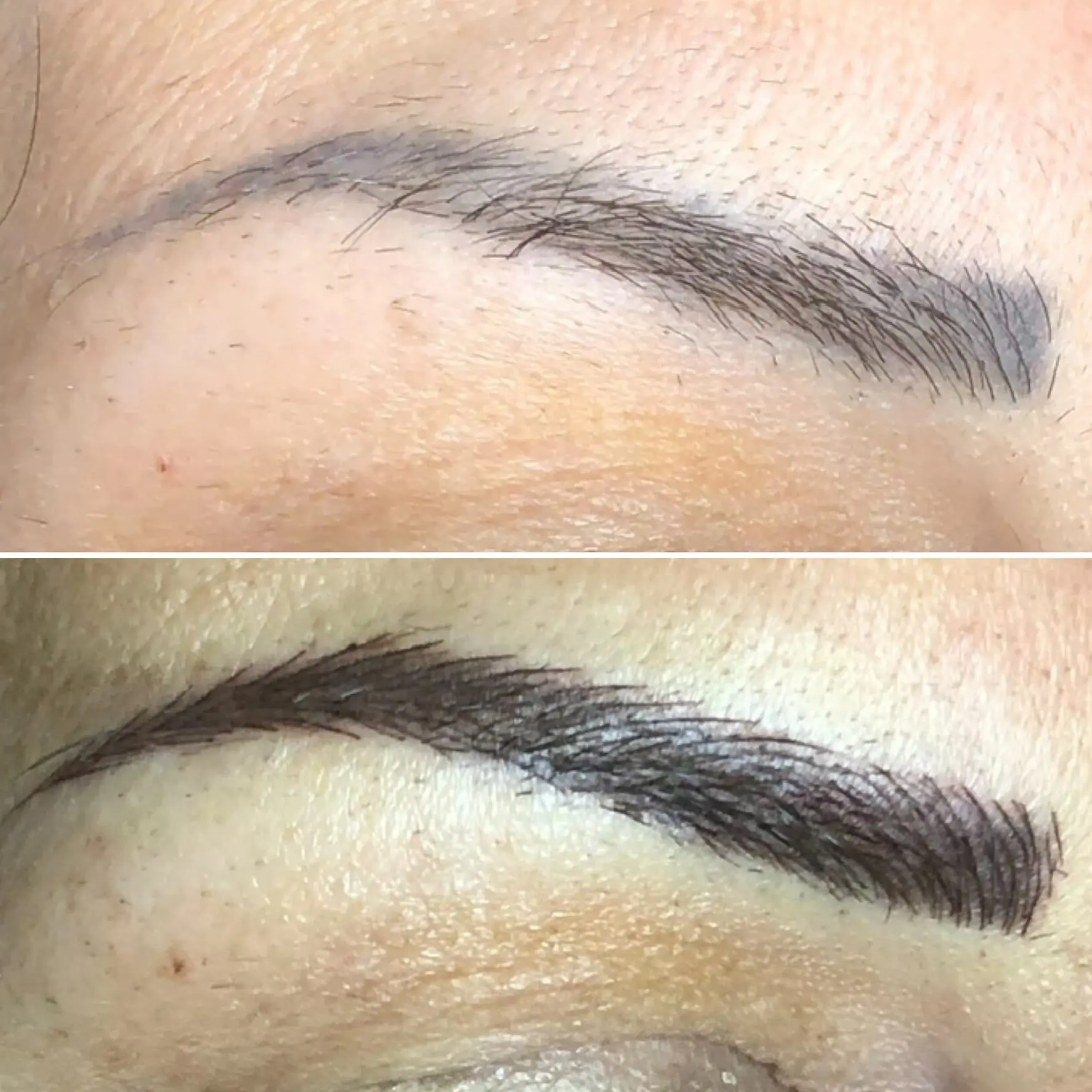 Brow correction comparison by Nadia Art